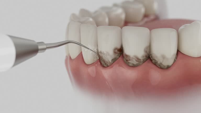 Reliable Dental Implants contractor in Marlborough, MO by Smile Center Dentistry